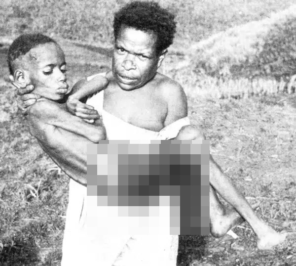 Loại bệnh lạ khiến người mắc phải cười cho đến chết, nguyên nhân đến từ một hủ tục rợn gáy của bộ tộc cổ xưa-2