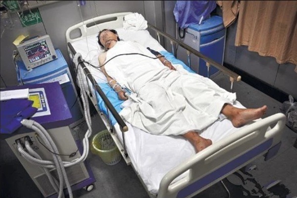 Người đàn ông 37 tuổi hôn mê rồi tử vong do nhồi máu não, bác sĩ cảnh báo thời điểm tuyệt đối không nên tắm-1