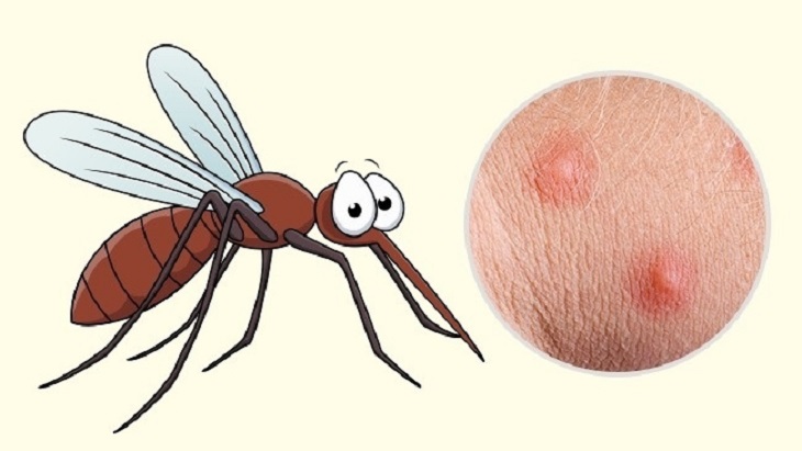 Hóa ra muỗi rất thích cắn những người này, mách bạn thêm cách phòng chống không gây rủi ro-2