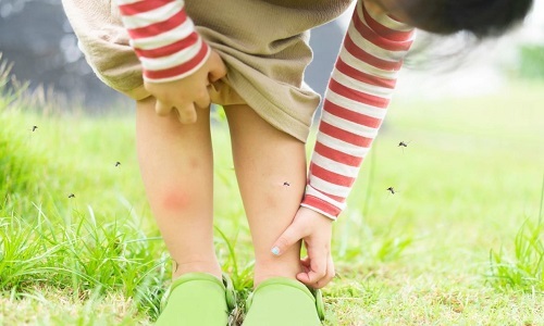 Hóa ra muỗi rất thích cắn những người này, mách bạn thêm cách phòng chống không gây rủi ro-1