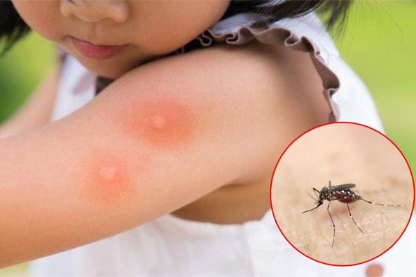 7 cách để loại bỏ lỗ đóng đinh trên tường, mọi dấu vết trở nên phẳng mịn như chưa bao giờ bị khoan-9