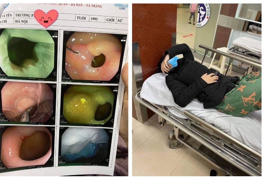 MXH dậy sóng với bài viết của cô gái Hà Nội tố ăn gimbap đến thủng dạ dày vì nuốt phải móc sắt”, tiết lộ chủ quán biếu tiền thăm hỏi nhưng lấy lại rồi biến mất”!?-1