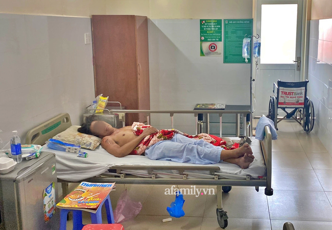 Nạn nhân sống sót trong vụ cháy 6 người chết ở Thủ Đức hối hận: Lẽ ra tôi phải đánh thức mọi người dậy hết…”-1