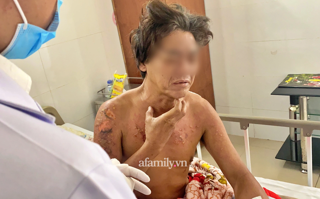 Nạn nhân sống sót trong vụ cháy 6 người chết ở Thủ Đức hối hận: Lẽ ra tôi phải đánh thức mọi người dậy hết…”-4