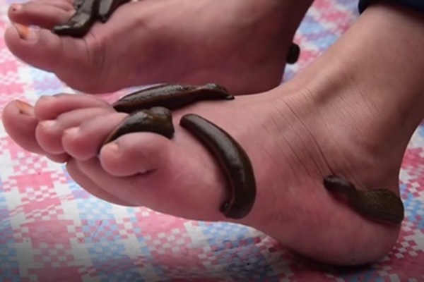 Clip: Kinh hãi cảnh gắp đỉa trong khoé mắt-1