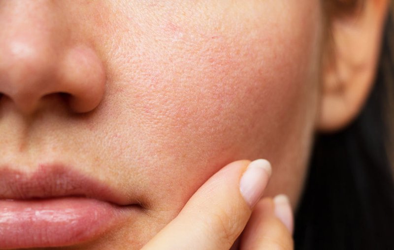 Da có lỗ chân lông to ngoác hay mụn đầu đen chi chít cũng sẽ láng căng chỉ bằng 5 tips nhanh gọn này-1