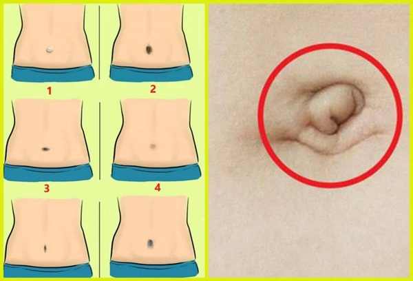 Nhìn tướng rốn 3 giây biết ngay tính cách và tương lai của bạn giàu có hay nghèo khổ trọn đời-2