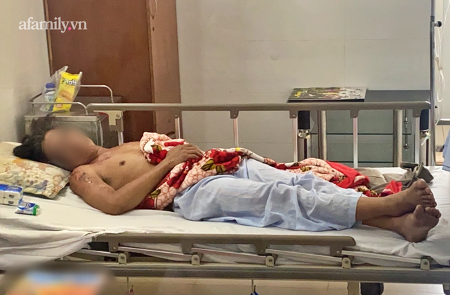 Người sống sót duy nhất trong vụ cháy nhà 6 người chết ở TP Thủ Đức được xuất viện sau 6 ngày điều trị-1