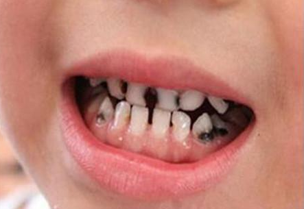 Cho trẻ nhỏ uống nước trái cây, tưởng là tốt nhưng sự thật lại khiến nhiều phụ huynh ngã ngửa-5