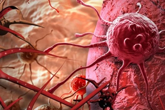 BS chuyên khoa ung thư: 20 quan điểm sai lầm về ung thư mong người dân thức tỉnh