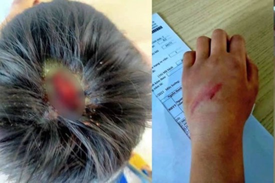 Cha đẻ ép con trai 9 tuổi về ở cùng 