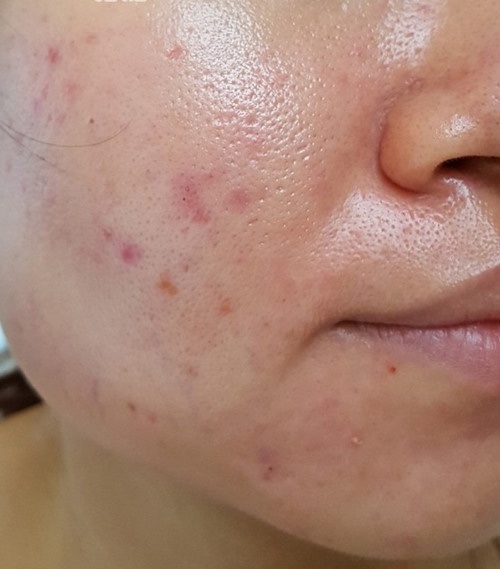 3 dòng mặt nạ đất sét kiềm dầu cực đỉnh giúp nàng da dầu thoát kiếp bóng nhẫy, bí bách trong mùa nóng nực sắp tới-1