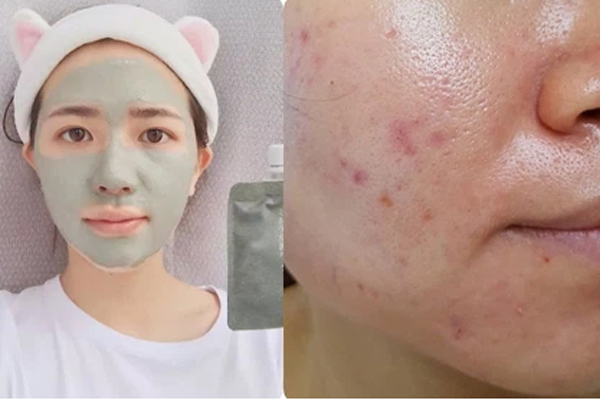 6 lọ gel dưỡng ẩm hoàn hảo cho mùa Hè vì siêu nhẹ mặt, bôi như không bôi mà da vẫn căng đét-7