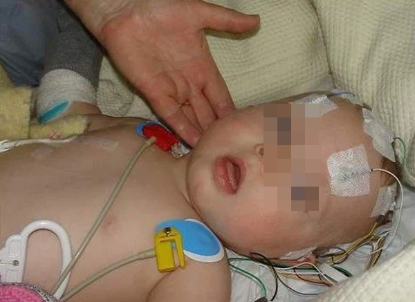 Bệnh viêm màng não mủ đặc biệt nguy hiểm khi thời tiết giao mùa: Triệu chứng, những đối tượng dễ mắc và việc cần làm để phòng bệnh-1