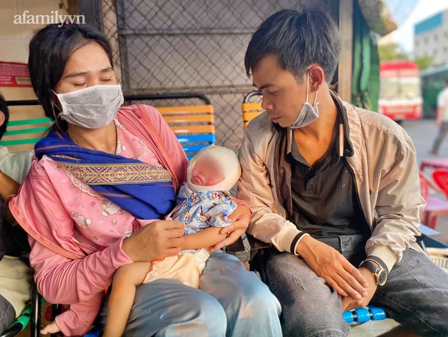 Bé gái 13 tháng tuổi té ụp mặt vào đống rác đang cháy xuất viện, cha nghẹn ngào ngày con được đón con về nhà-1