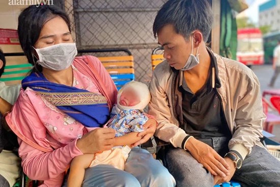 Bé gái 13 tháng tuổi té ụp mặt vào đống rác đang cháy xuất viện, cha nghẹn ngào ngày con được đón con về nhà