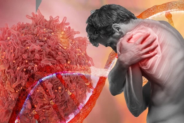 Bị ung thư phổi, cô gái khóc nấc khi lỡ chủ quan bỏ qua dấu hiệu nguy hiểm này ở ngón tay-4