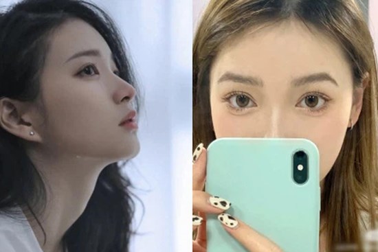 Giấu chồng đi thẩm mỹ để níu kéo hôn nhân, số phận người phụ nữ cuồng mắt 2 mí đảo lộn hoàn toàn sau cuộc phẫu thuật hỏng