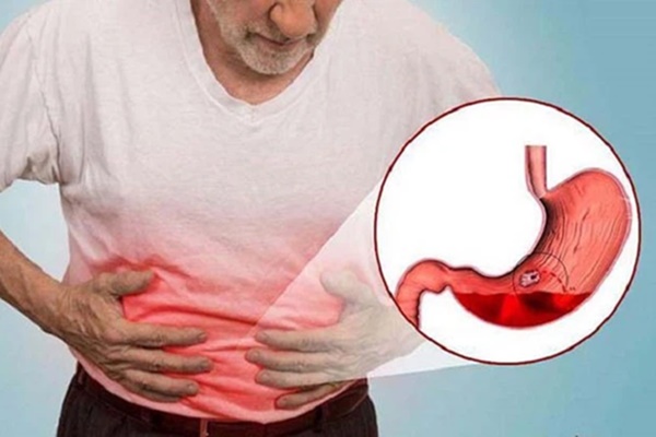 Để giữ dạ dày không bị thủng, hãy thay đổi 5 thói quen xấu này càng sớm càng tốt-1