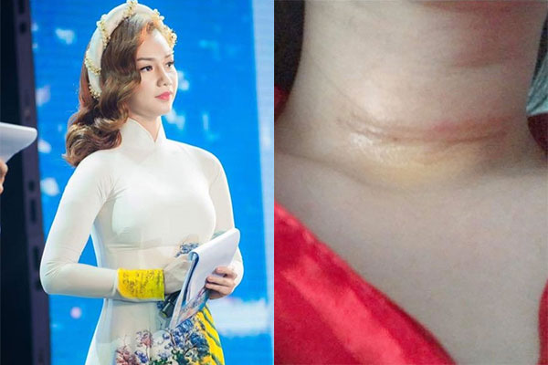 MC bị chó giật mic khi đang ghi hình trực tiếp-1