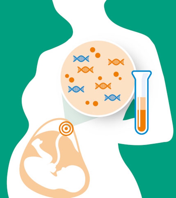 Những thiếu nữ... cả đời không dậy thì và hội chứng bất thường nhiễm sắc thể cướp đi mơ ước làm mẹ: Làm sao để biết một đứa trẻ có nguy cơ bị bệnh này?-9