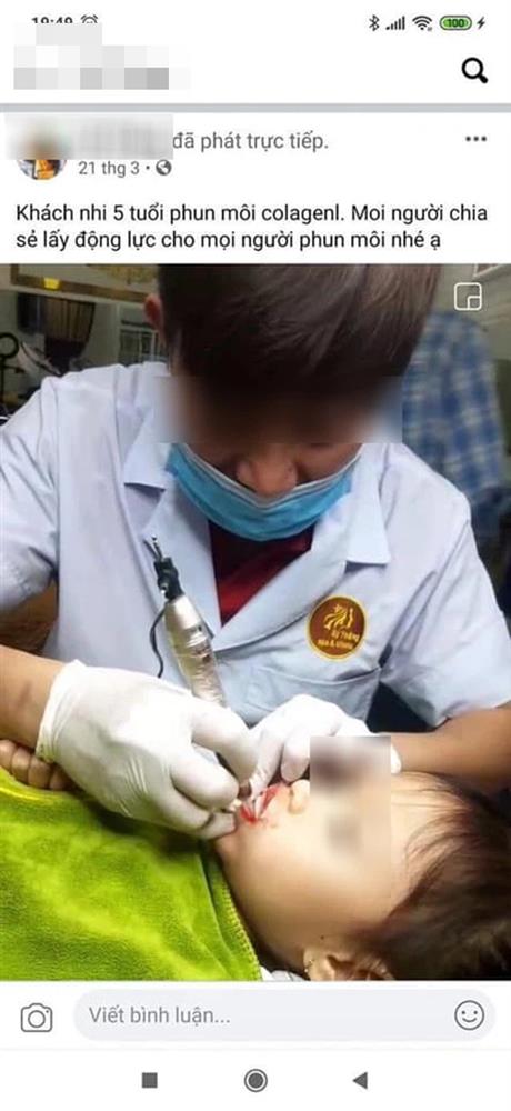 Từ chuyện bé 5 tuổi phun môi collagen: Phun xăm môi cho trẻ em dẫn đến những hệ lụy gì?-1