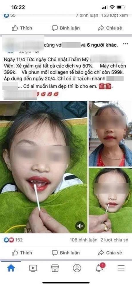 Từ chuyện bé 5 tuổi phun môi collagen: Phun xăm môi cho trẻ em dẫn đến những hệ lụy gì?-2