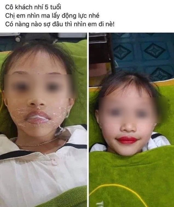 Từ chuyện bé 5 tuổi phun môi collagen: Phun xăm môi cho trẻ em dẫn đến những hệ lụy gì?-4