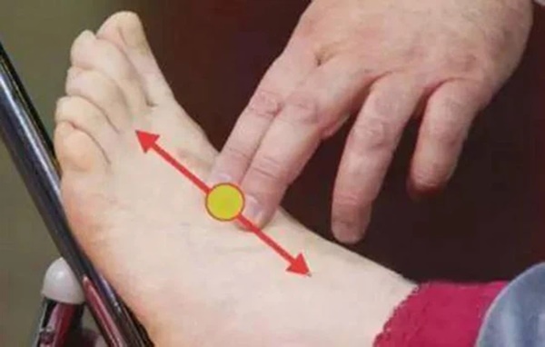 Đây là 3 cách kiểm tra cực nhanh giúp bạn biết được mình có nguy cơ bị tắc nghẽn mạch máu hay không?-1