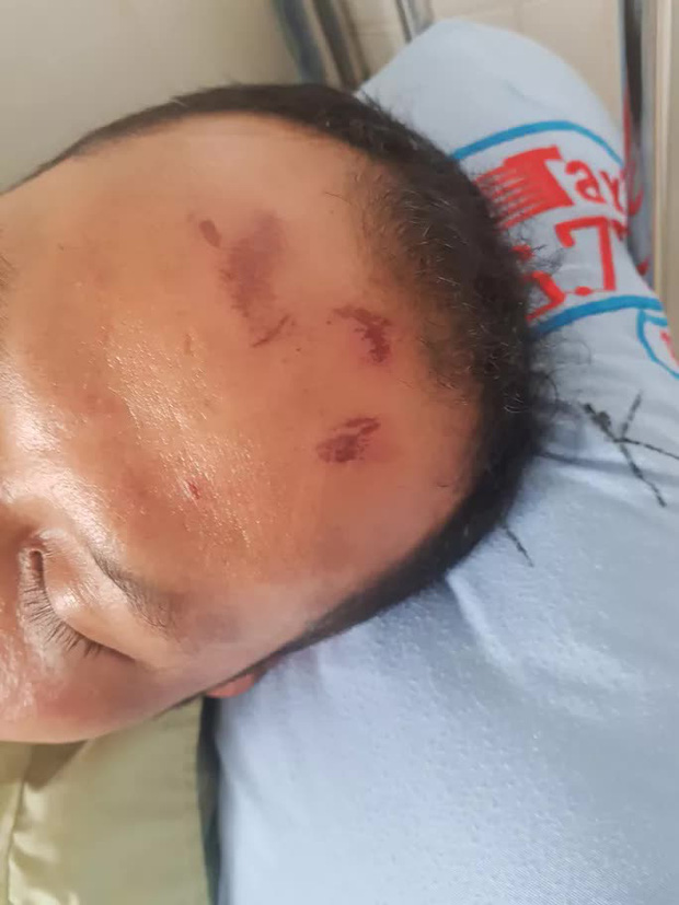 Truy tìm Phúc bổ - kẻ cầm đầu nhóm côn đồ đánh hội đồng 1 người dã man-2