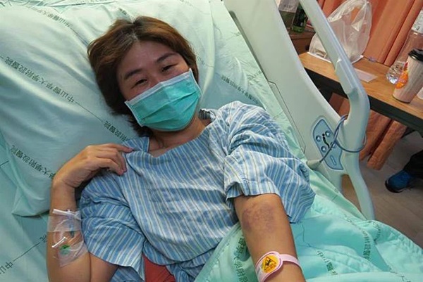 Bị ung thư phổi, cô gái khóc nấc khi lỡ chủ quan bỏ qua dấu hiệu nguy hiểm này ở ngón tay-1