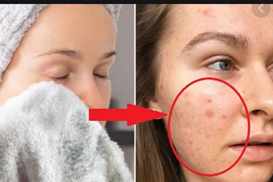 Nếu biết lý do khiến làn da ngày càng nhăn nheo mụn nhọt, bạn sẽ 