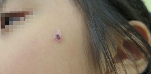 Bé gái 5 tuổi bị bố và mẹ kế bạo hành đến chết: Bị ném lên trần nhà, cơ thể kiệt quệ như người già, chết cũng không được no bụng-3