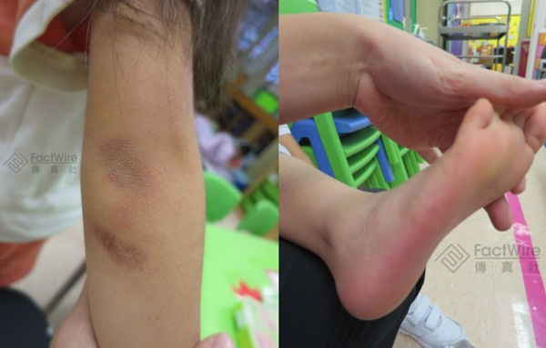 Bé gái 5 tuổi bị bố và mẹ kế bạo hành đến chết: Bị ném lên trần nhà, cơ thể kiệt quệ như người già, chết cũng không được no bụng-4