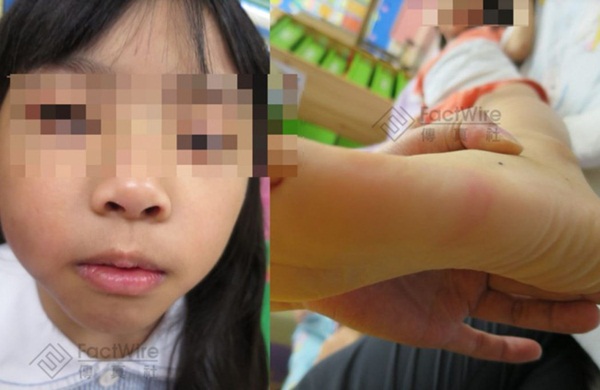 Bé gái 5 tuổi bị bố và mẹ kế bạo hành đến chết: Bị ném lên trần nhà, cơ thể kiệt quệ như người già, chết cũng không được no bụng-5