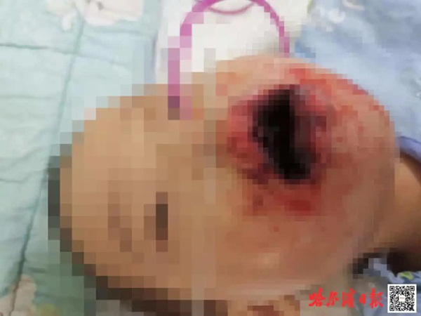 Nghe tiếng con trai khóc, bố mẹ chạy vào phát hiện miệng con chứa đầy bột trắng, phản ứng sai lầm tiếp theo suýt trở thành nỗi ân hận cả đời-1