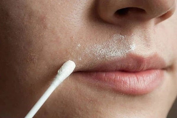 Khuôn mặt của phụ nữ xuất hiện 4 điểm xấu xí này, chứng tỏ tử cung có vấn đề-2
