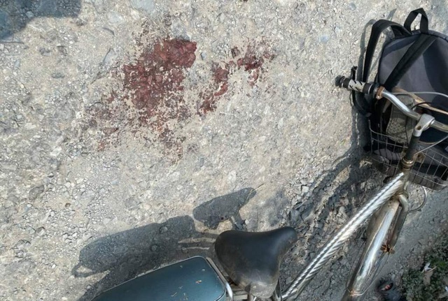 Học sinh lớp 8 đâm bạn đến nguy kịch rồi khai có người thuê-1