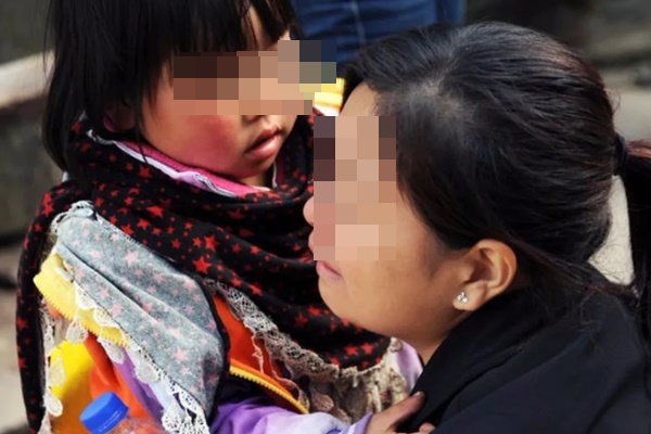 2 mẹ con cùng mắc bệnh ung thư ruột bởi những món ăn quen thuộc này-1