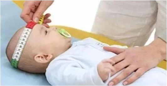Thấy đầu của con to hơn nhiều so với bạn cùng tuổi, cha mẹ tưởng trẻ thông minh nhưng khi biết sự thật lại hoảng sợ-3