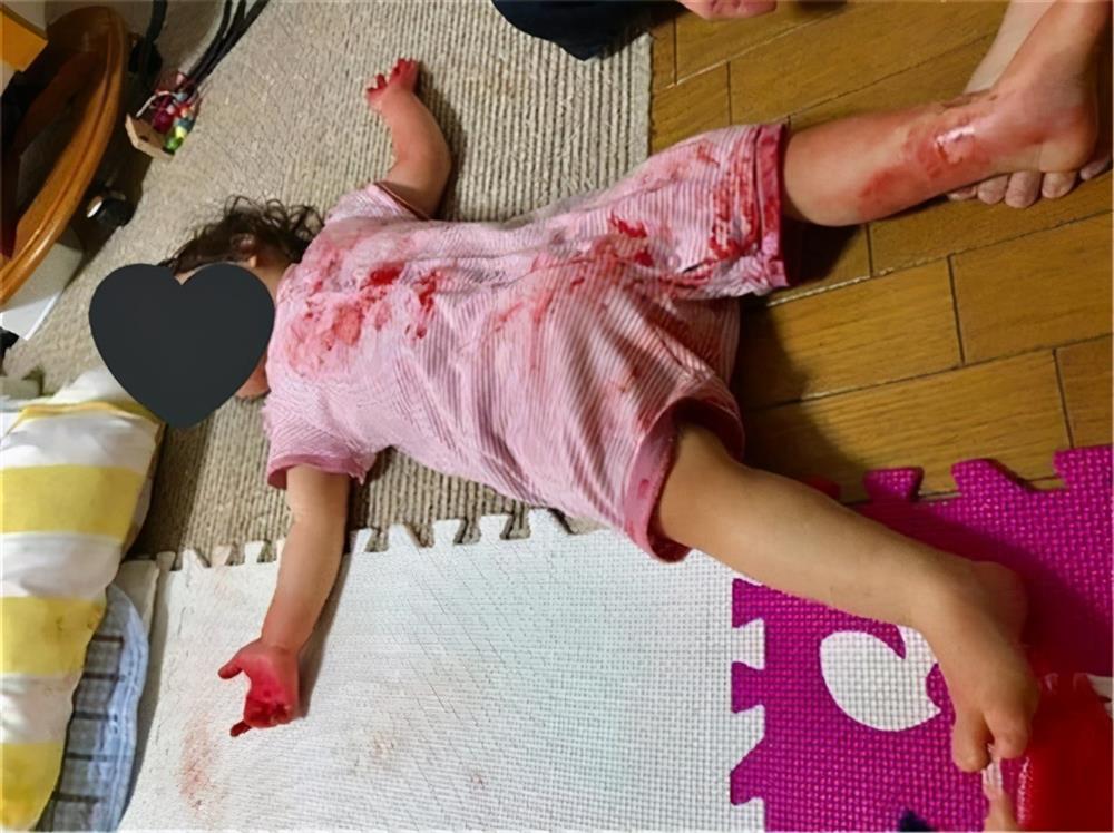 Để con trên nhà để xuống lấy đồ của shipper, khi mở cửa mẹ sốc nặng khi nhìn thấy thứ trên người cô bé-3