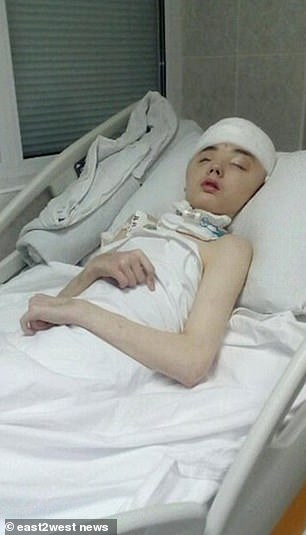 Mang quả tạ 3kg ra chống trả gã hàng xóm đang cưỡng hiếp mẹ, cậu bé bị đánh méo hộp sọ, mẹ ám ảnh không dám đến thăm con và cái kết đau lòng-7