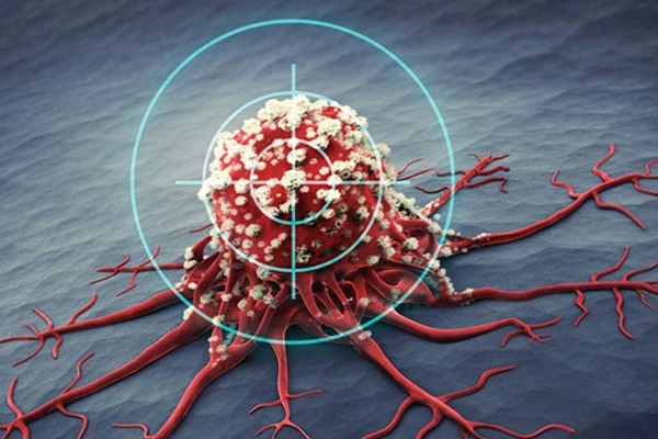 Người phụ nữ bị nghẹt tai tưởng là do ráy tai nhưng khi đi khám lại được chẩn đoán mắc ung thư-5