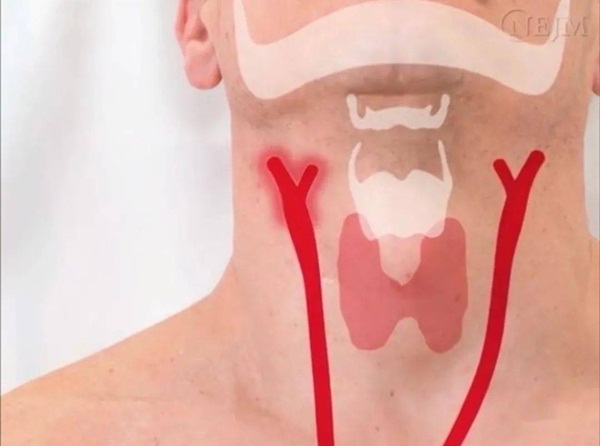 Trên cổ có một khu vực chính là điểm chết, không nên hôn, xoa bóp quá mạnh vì có thể gây đột tử-2