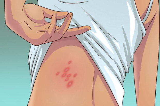 5 dấu hiệu cho thấy rệp đang làm tổ trong nhà của bạn, hãy cẩn thận-1