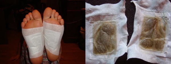 Lật mặt miếng dán thải độc chân dưới góc nhìn của chuyên gia Mỹ: Lợi đâu chưa thấy đã tốn tiền và hỏng… da chân-3