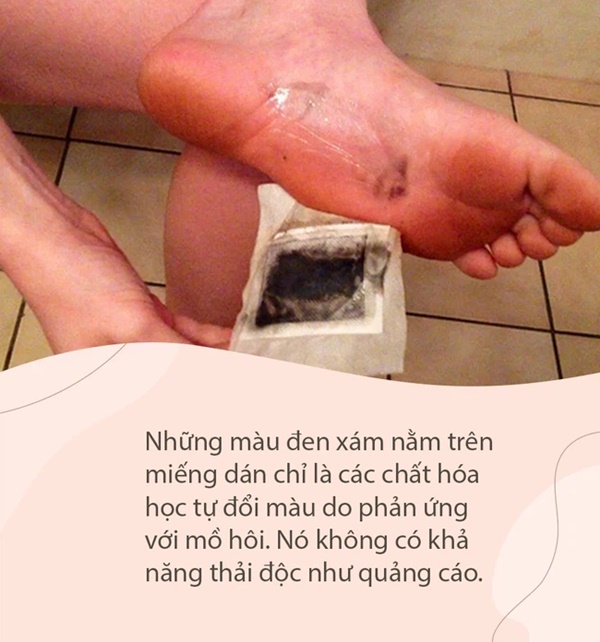 Lật mặt miếng dán thải độc chân dưới góc nhìn của chuyên gia Mỹ: Lợi đâu chưa thấy đã tốn tiền và hỏng… da chân-4