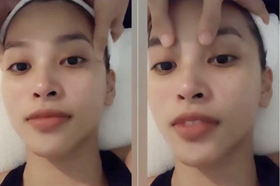 Tiểu Vy căng da không cần 'dao kéo' nhờ liệu pháp massage