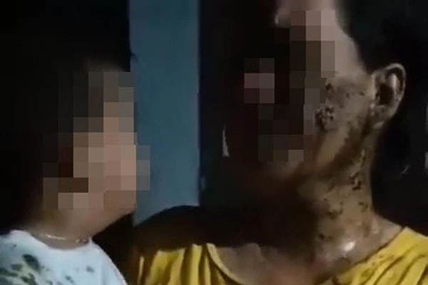 Công an vào cuộc vụ bé 2 tuổi ở Phú Yên bị người lớn đổ phân lên người để đòi nợ-3