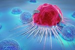 3 dấu hiệu xuất hiện ở vùng chân ngầm cảnh báo nguy cơ mắc ung thư cổ tử cung cao-4